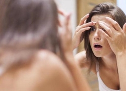 Фото: Симптомы гиперандрогении